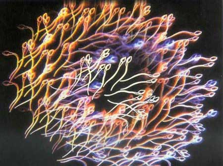 不孕不育原因分析